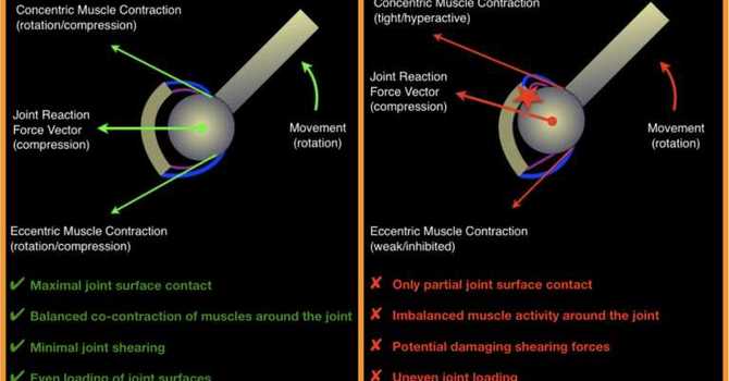 Understanding Joint Centration: The Key to Optimal Movement and Health image